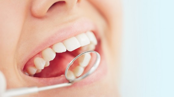 How to Prevent Dental Caries