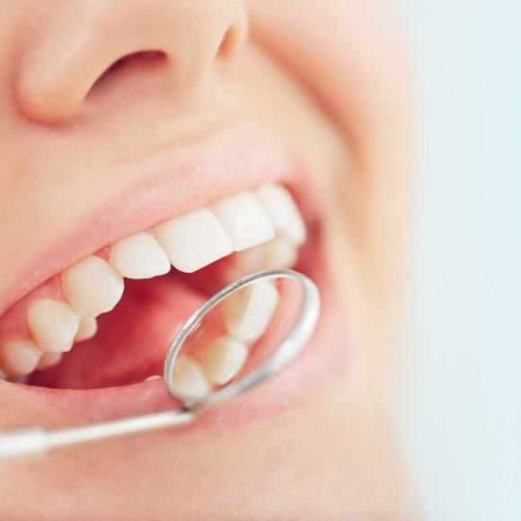 How to Prevent Dental Caries