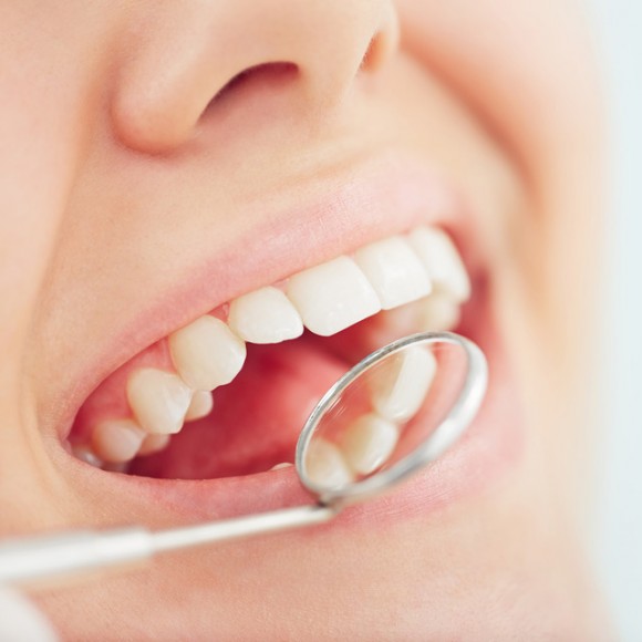 Aligning the Teeth