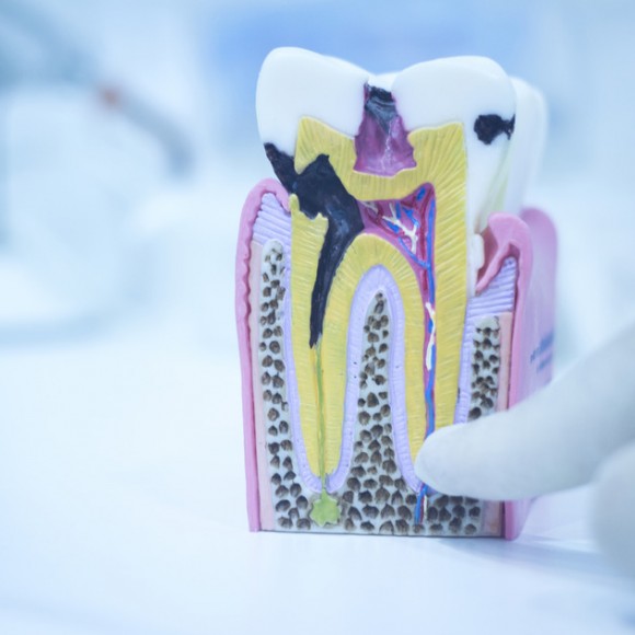 Denists Against Root Canals